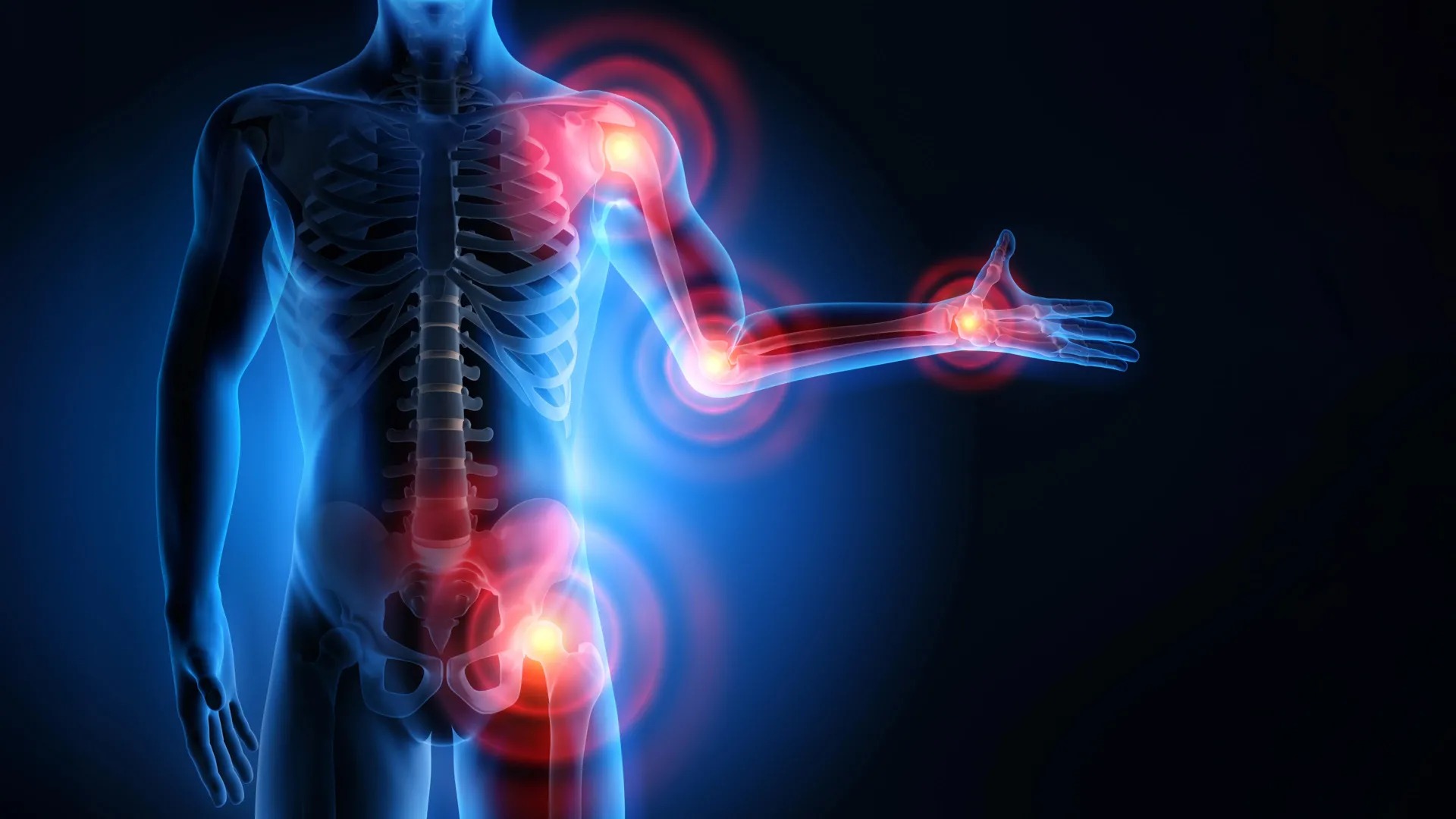 Braking Inflammation: Discovery of the Native Metabolic Switch Halting Chronic Autoimmunity