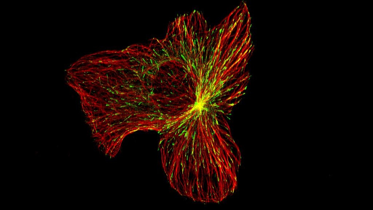Dismantling RAS: Daraxonrasib Delivers 84% Disease Control in Pancreatic Cancer