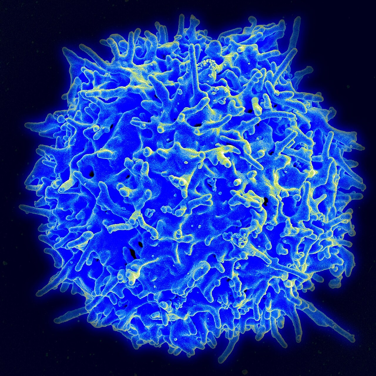 Universal Off-the-Shelf Base-Edited CAR-T Therapy